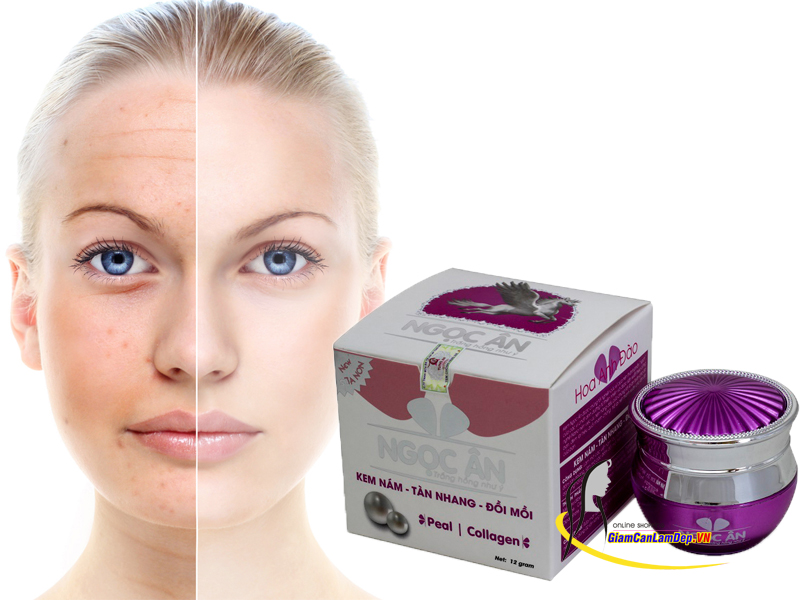 Mỹ Phẩm Trị Nám Ngọc Ân 15gr - Dưỡng Trắng Da, Đặc Trị Nám, Tàn Nhang, Đồi Mồi (COD: 12)
