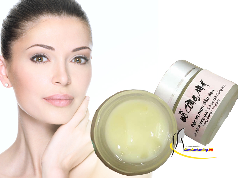 Kem Đặc Trị Mụn Đầu Đen Bồ Công Anh - Đông Y Bà Vân