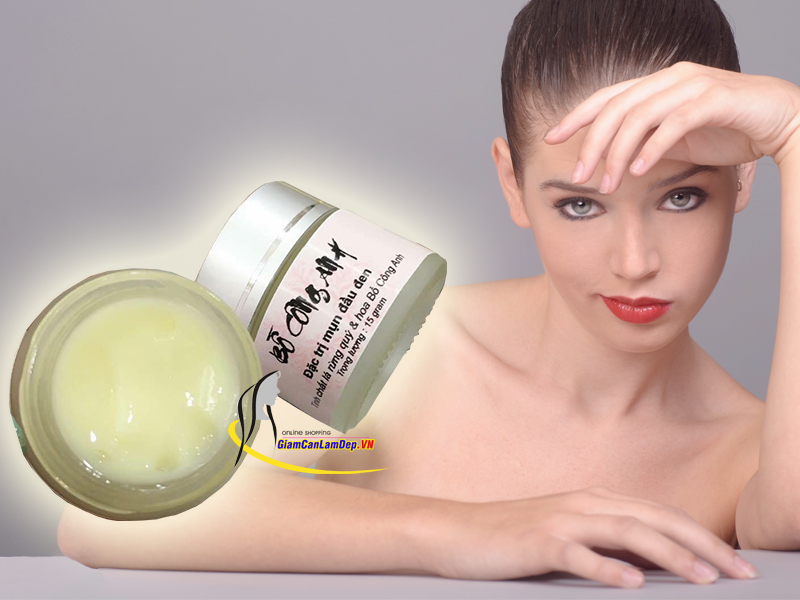Kem Đặc Trị Mụn Đầu Đen Bồ Công Anh - Đông Y Bà Vân